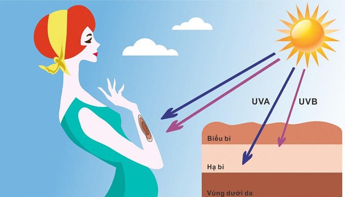 Tia UV rất có hại cho da