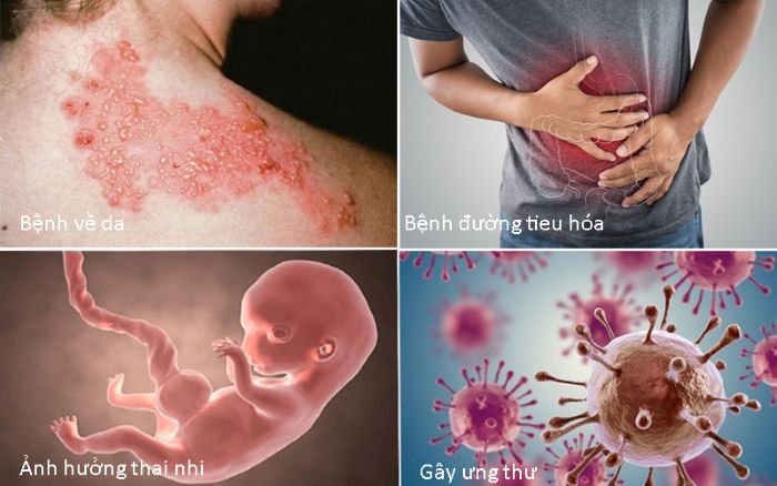 o nhiem moi truong nuoc